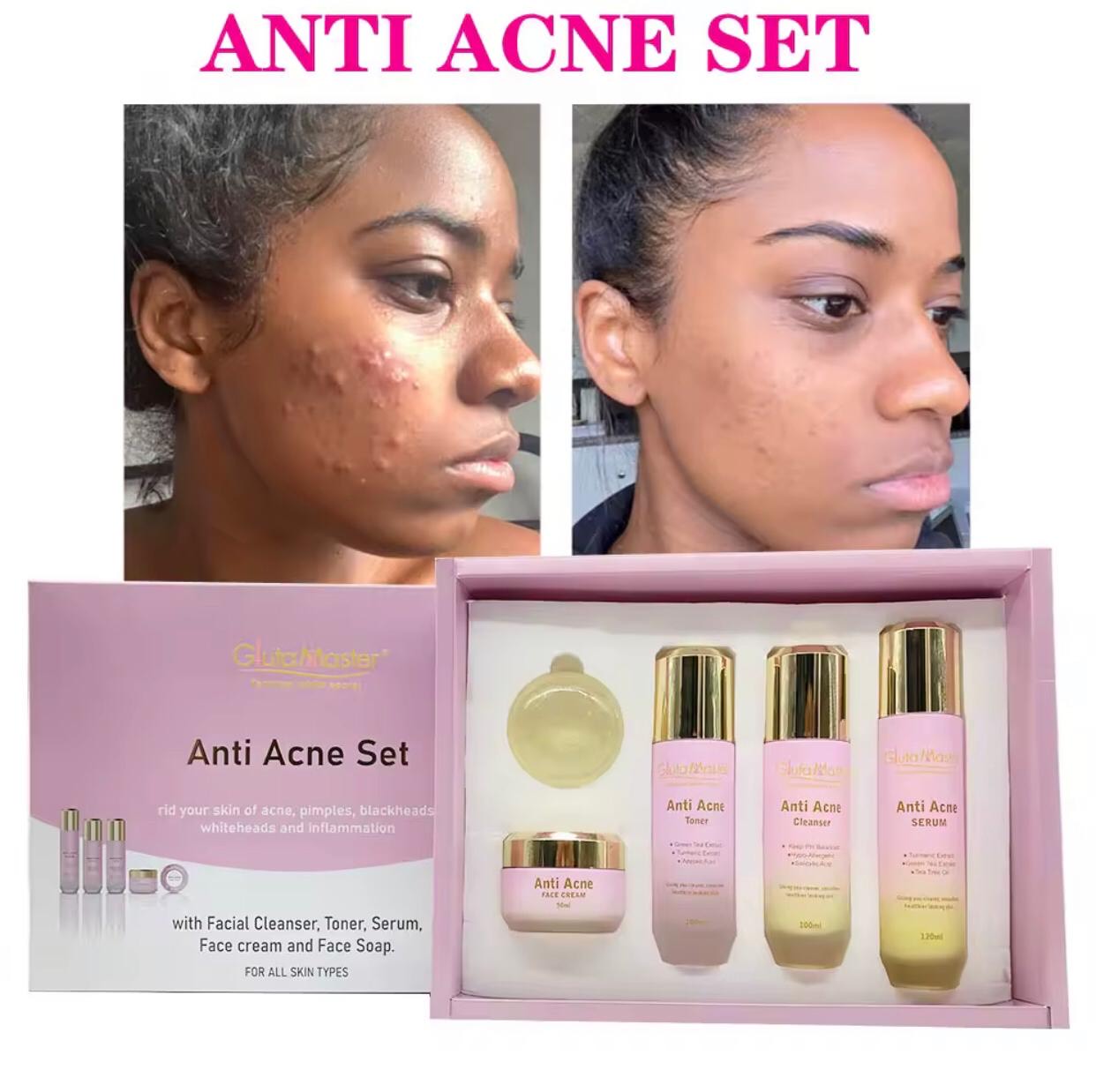 Kit anti-acné glutamaster